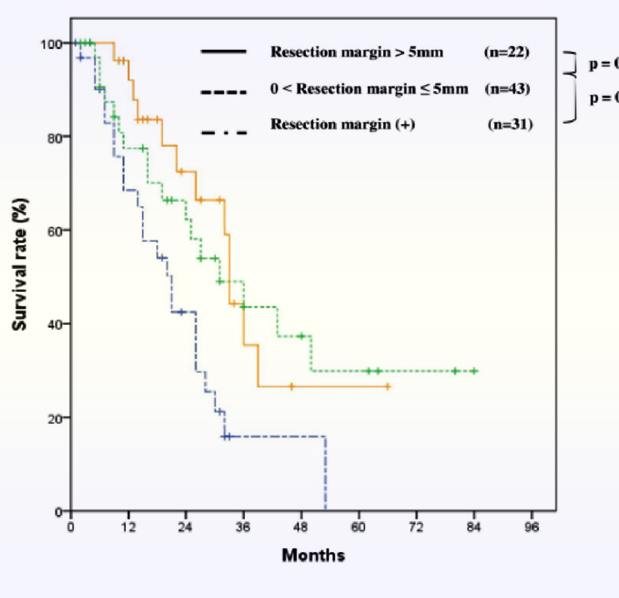 простые расчёты free margin что означает маржа
